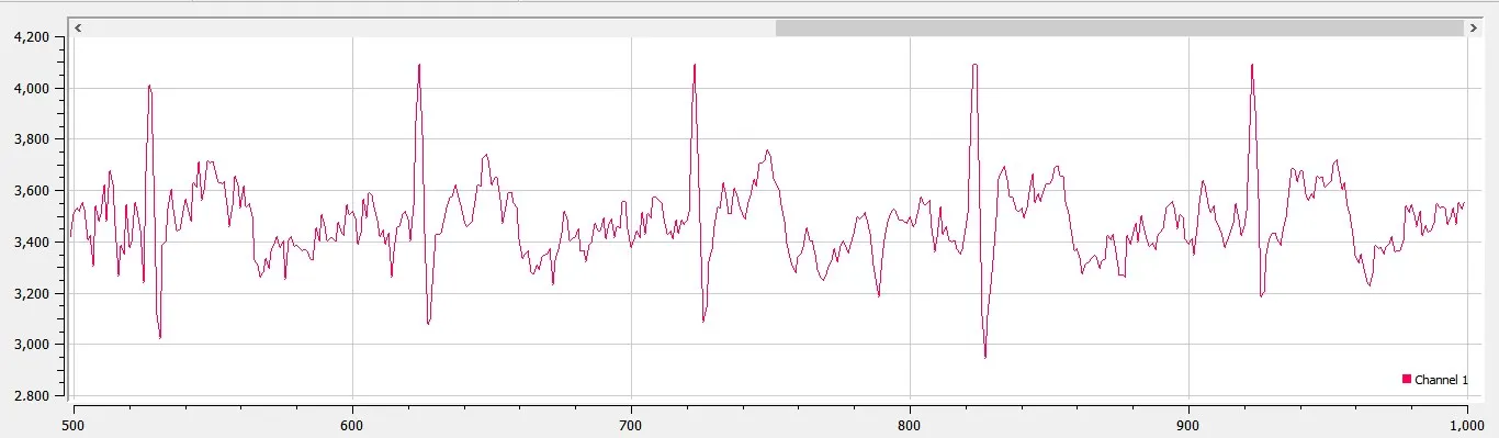 ECG noise free.jpg