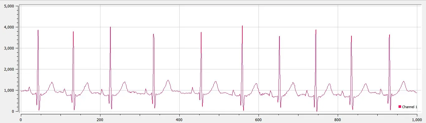 raw_ecg.jpg