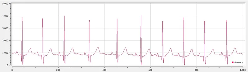 raw_ecg