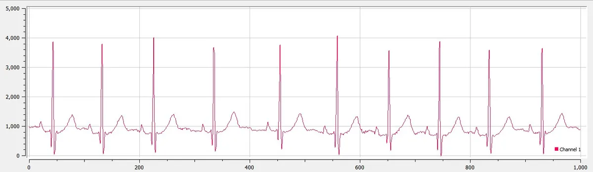 raw_ecg